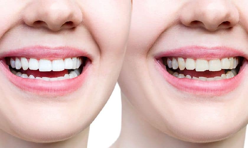 Cosmetic Dentistry Magnolia