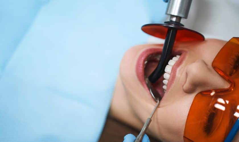 Root Canal Therapy Magnolia