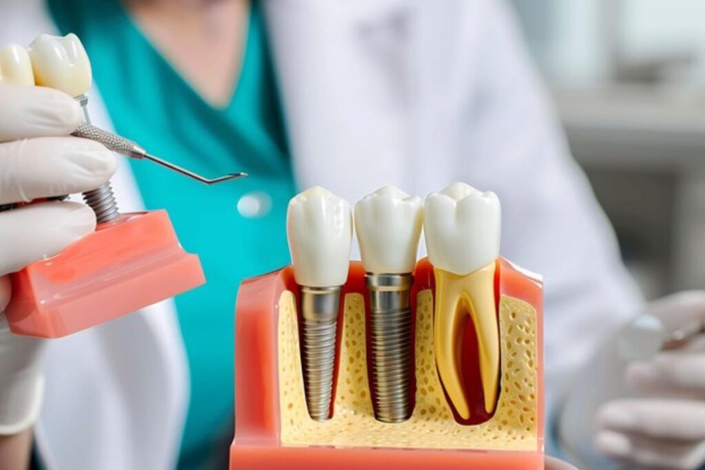 Dental Implants Magnolia