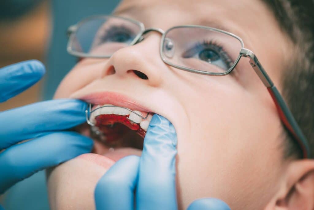 Orthodontic Treatment in Magnolia