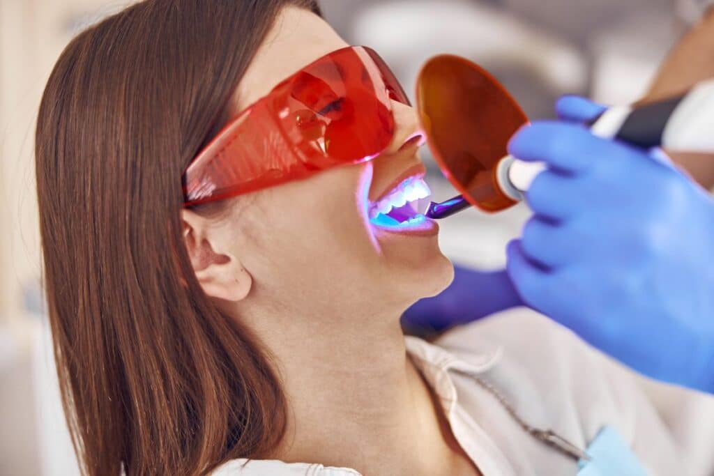 Teeth Whitening Magnolia