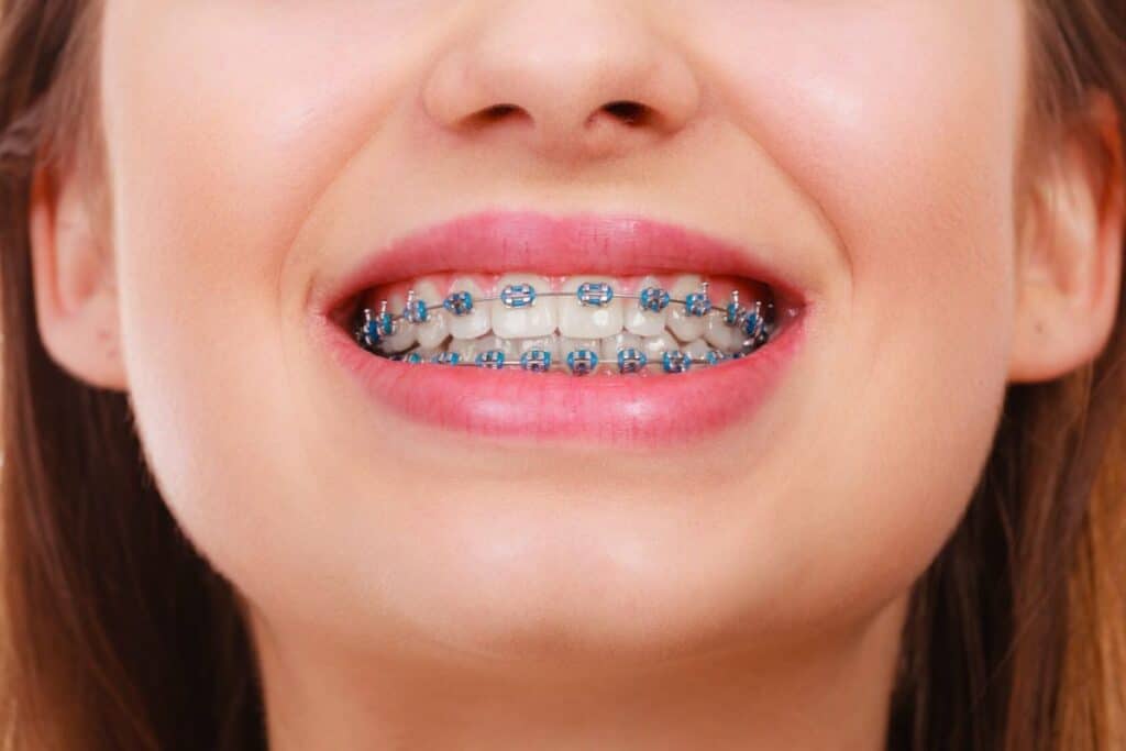 Orthodontic Treatment Magnolia
