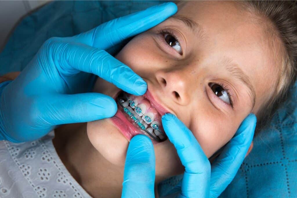 Orthodontic Treatment Magnolia
