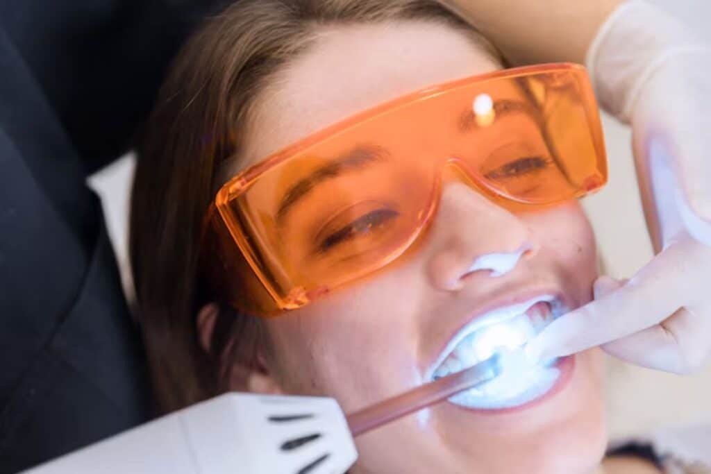 Teeth Whitening Magnolia