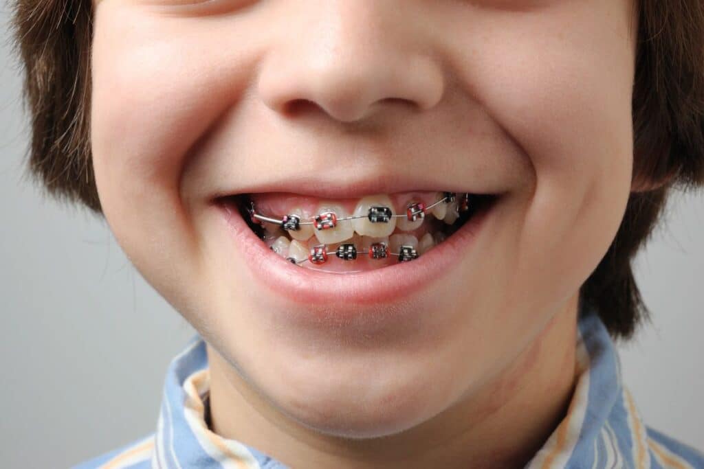 Orthodontic Treatment Magnolia