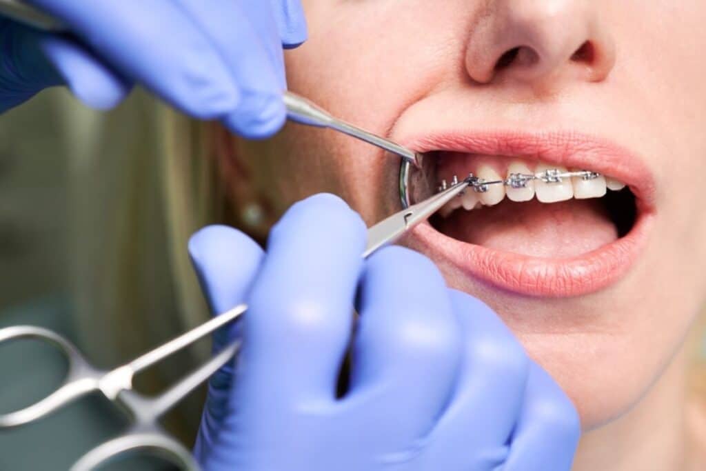 Orthodontic Treatment Magnolia