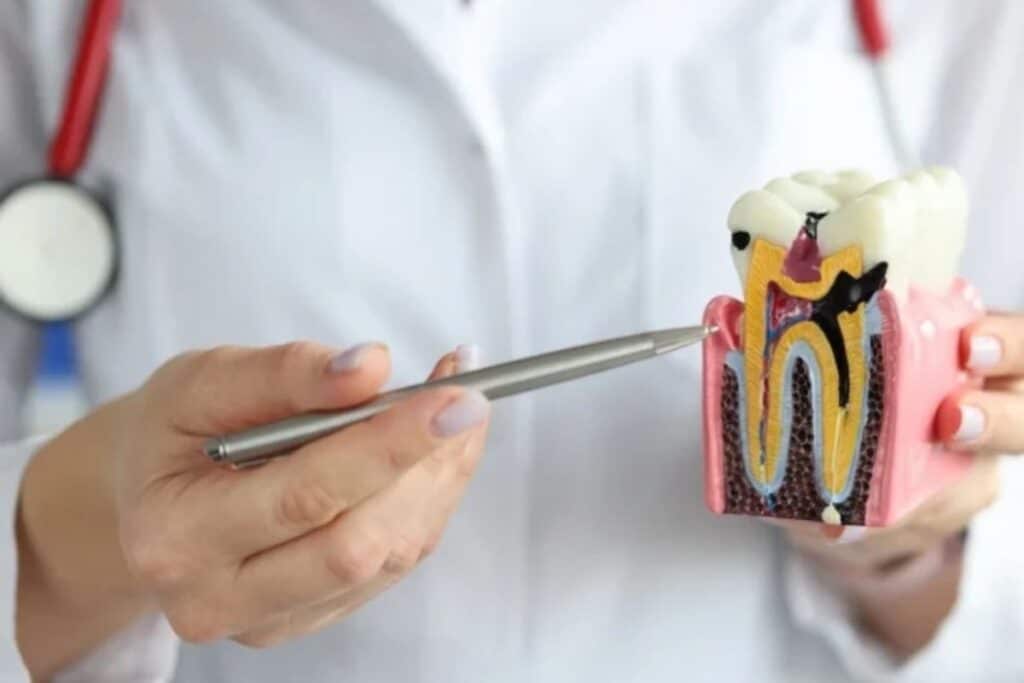 See an Endodontist Without a Referral