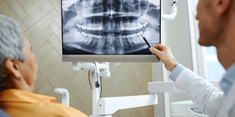 Importance of Regular Dental X-Rays
